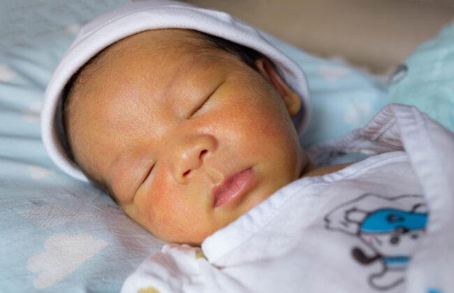Top 9 mẹo dân gian chữa vàng da ở trẻ sơ sinh tại nhà hiệu quả