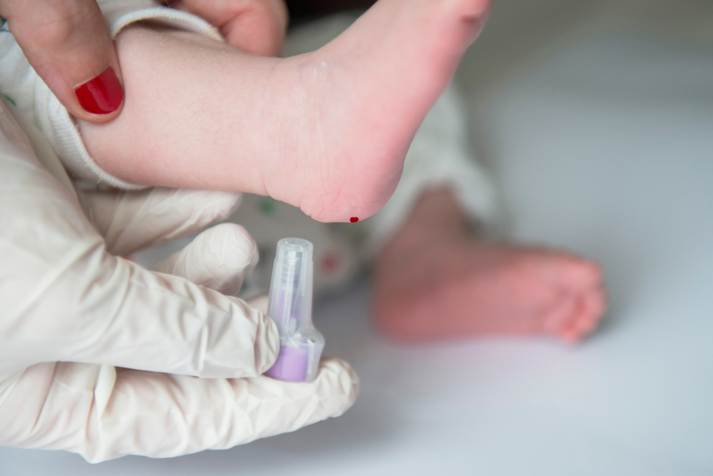 Lấy máu gót chân trẻ sơ sinh để làm gì? Có an toàn không?