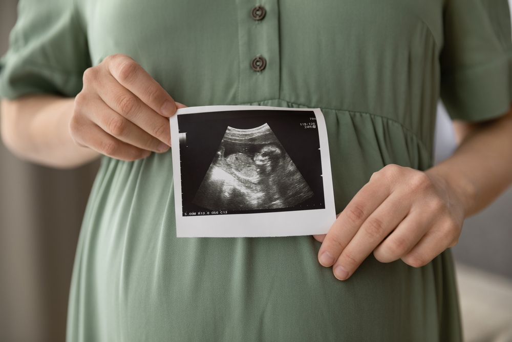 Phù thai là gì? Là tình trạng thai nhi có sự tích tụ chất lỏng bất thường ở các mô và cơ quan dẫn đến phù nề khắp cơ thể