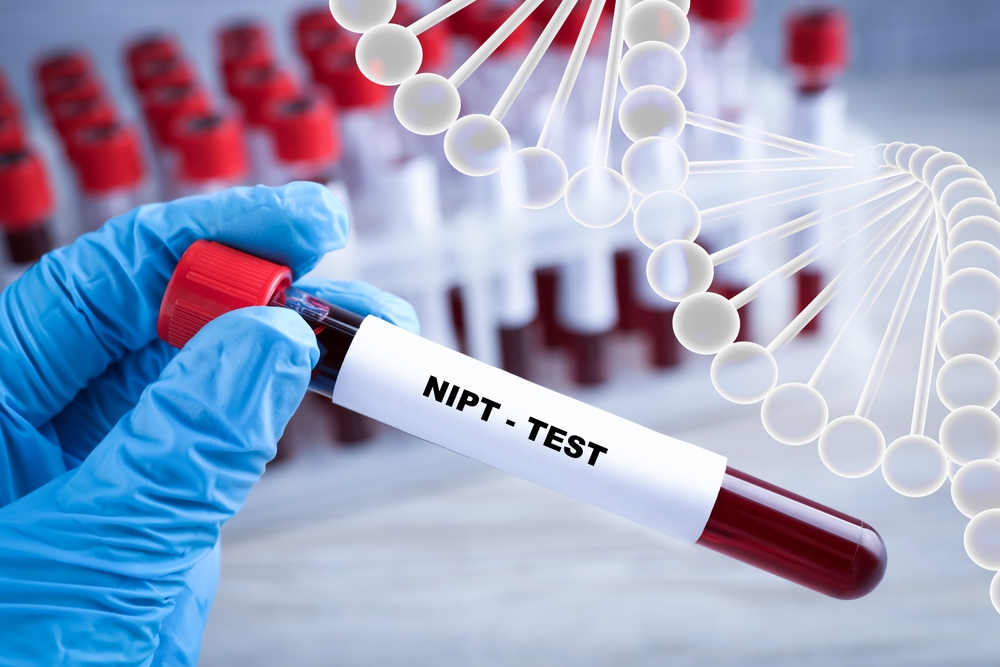 Xét nghiệm NIPT là gì? Xét nghiệm NIPT biết được những gì?