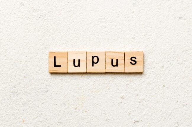 Bạn biết gì về bệnh lupus ban đỏ ở trẻ em?