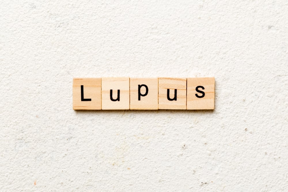 Bạn biết gì về bệnh lupus ban đỏ ở trẻ em?