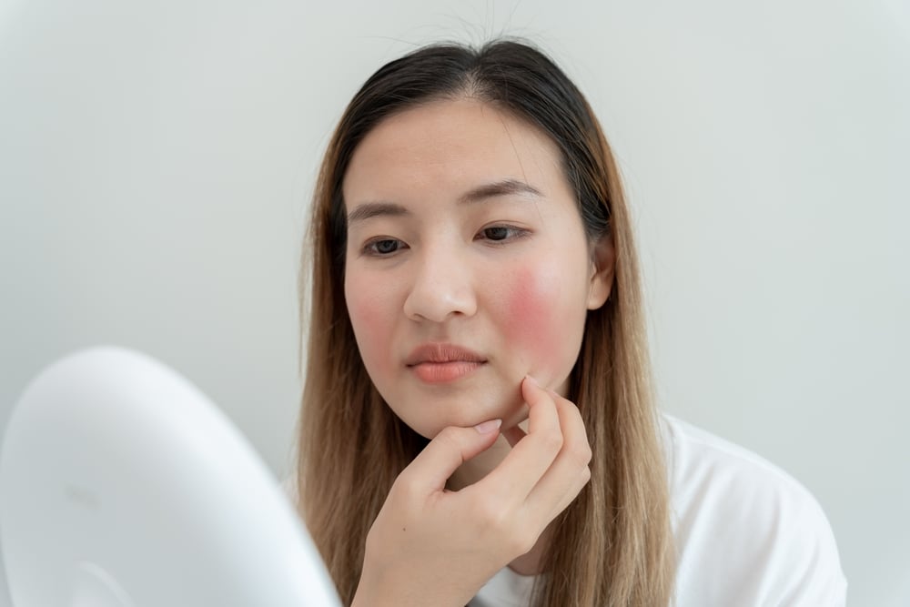 Triệu chứng bệnh lupus ban đỏ ở trẻ em