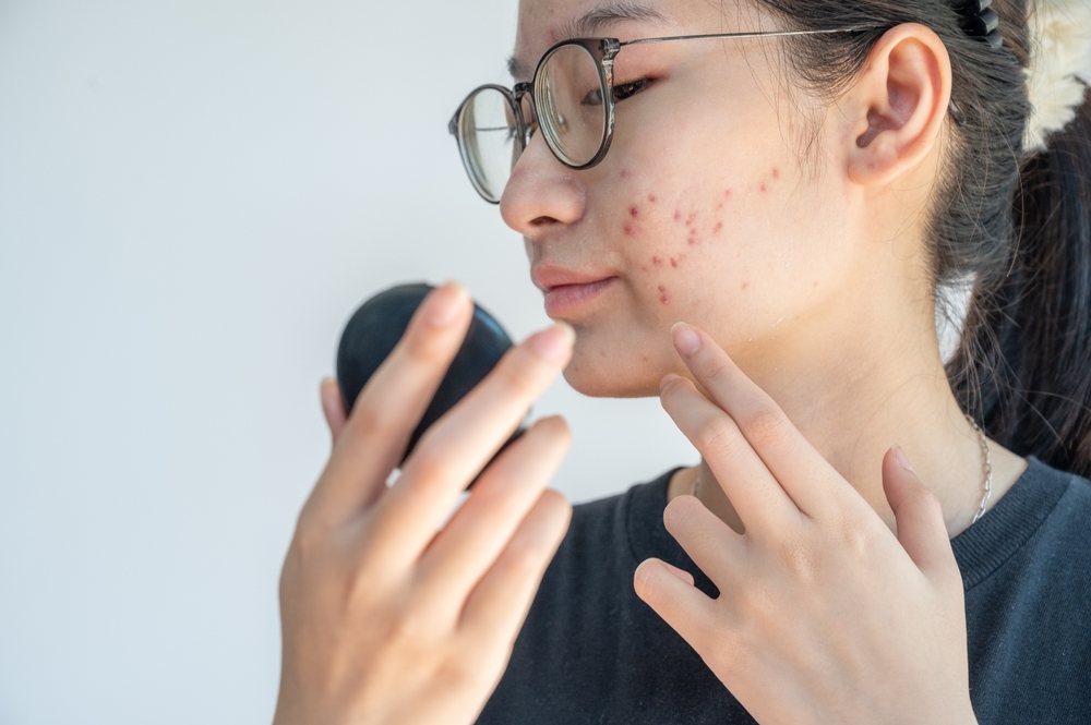 tuổi dậy thì là gì