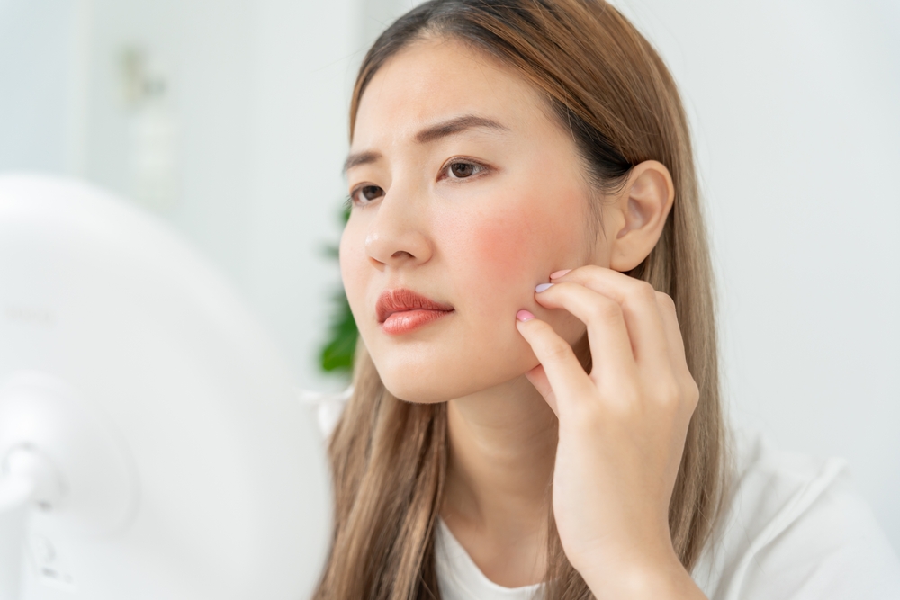 dấu hiệu nhận biết da nhạy cảm